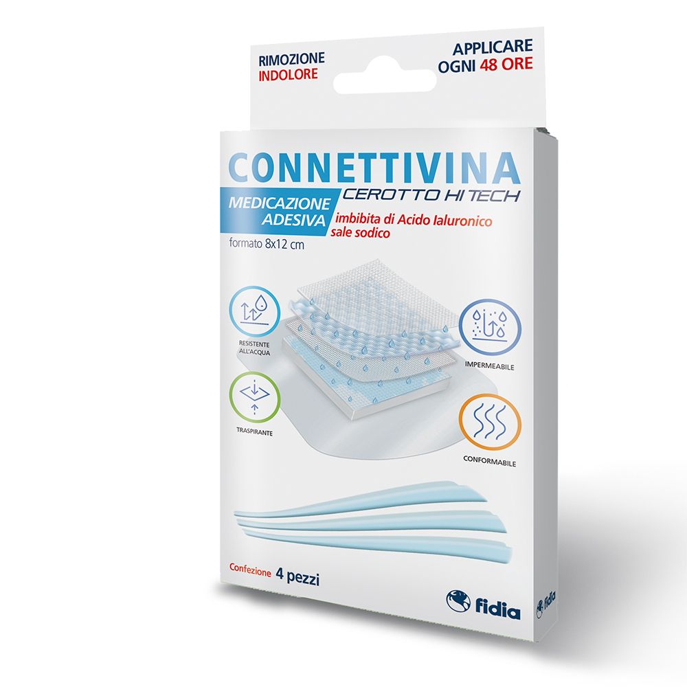 Connettivina 